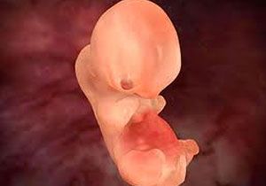 Embriyoya Genetik Tan le Kaltsal Hastalklar Belirleniyor	