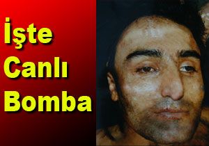 Canl Bomba DHKP-C yesi kt