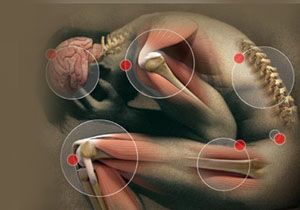 Dnyay Titreten Hastalk: Parkinson