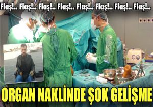 Nakledilen Btn Uzuvlar Alnd